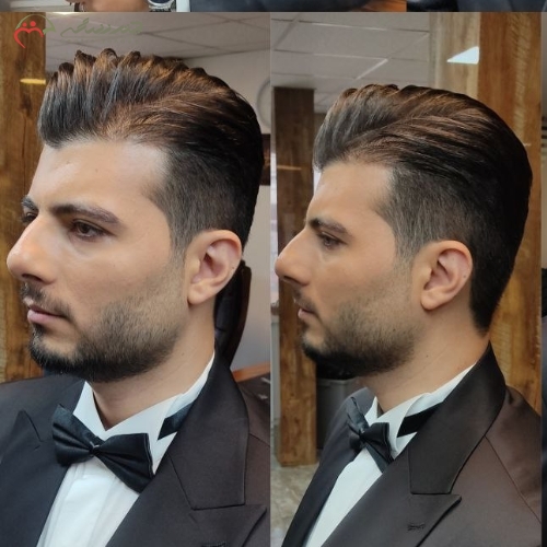 سفارش و رزرو آنلاین اصلاح کامل سر و صورت داماد، برداشت جوش ها، کراتینه موقت ،فیکساتور گریم صورت | چترزندگی